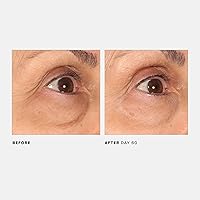 U Beauty The RETURN Eye Concentrate 0.5 fl oz — image 7