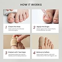 Treatonic Ingrown Toenail Treatment Kit — image 7