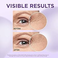 L'Oreal Paris Revitalift Derm Intensives Hyaluronic Acid + Caffeine Hydrating Eye Serum 0.67 Fl. Oz. — image 5