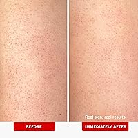 First Aid Beauty KP Bump Eraser Body Scrub 8 oz — image 3