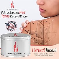 Tattoo Destroyer Tattoo Removal Cream 1oz — image 3
