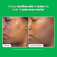 Paula's Choice BOOST 10% Azelaic Acid Booster — image 4