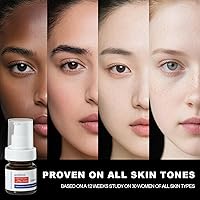 SINPIN aobenz Dark Spot Remover for Face & Body, 1.35 Fl Oz — image 5