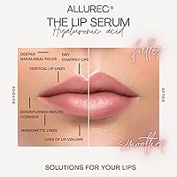 ALLUREC Lip Plump Perfection Filler — image 3