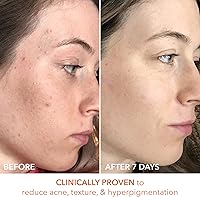 Dr. Dennis Gross Alpha Beta Universal Daily Peel (60 Treatments) — image 8