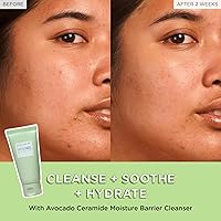 Glow Recipe Fruit Babies Skincare Kit — image 3