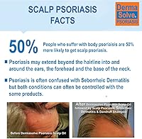Dermasolve Scalp Psoriasis & Dandruff Shampoo with Conditioner — image 7