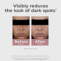 Eucerin Radiant Tone Dual Serum Dark Spot Corrector 1 Fl Oz — image 4