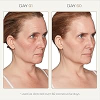 Tru Alchemy Spot Check Dark Spot Remover Serum 1 fl oz — image 4