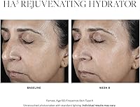 SkinMedica HA5 Rejuvenating Hydrator 2 Oz — image 7
