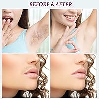 YONHAI Waxing Kit with 4 Hard Wax Beans & 10 Applicator Sticks — image 6