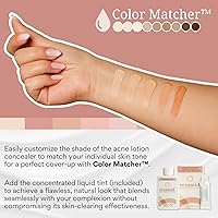 Rezamid Acne Spot Treatment Lotion 2oz — image 5