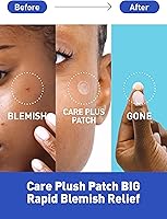 OLIVE YOUNG Care Plus Spot Patch | Hydrocolloid Acne Patch (510 count) — image 3