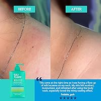 Suu Balm Anti Itch Body Wash 28.4 fl oz — image 6