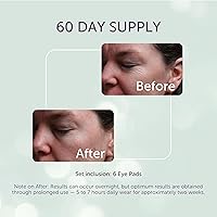 SilcSkin Silicone Eye Pads - 60 Day Supply — image 3