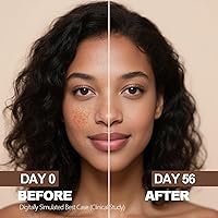 SINPIN aobenz Dark Spot Remover for Face & Body, 1.35 Fl Oz — image 4