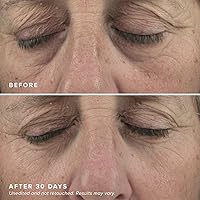 DRMTLGY Brightening Eye Masks (30 Pairs) — image 5