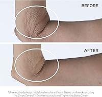 StriVectin Tighten & Lift Crepe Control Body Cream 5oz — image 3