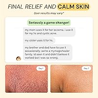 MyMagicHealer Universal Flare Care 1 oz — image 4