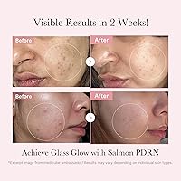 Medicube Pink PDRN Trio Gift Set — image 4