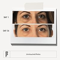 RODAN + FIELDS Active Hydration Bright Eye Complex 15mL — image 3