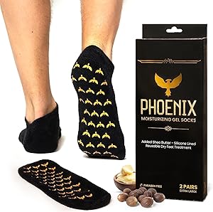 Phoenix Foot Peel Moisturizing Gel Socks for Men - Extra Large (2 Pairs) Review
