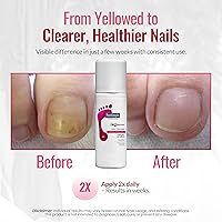 FOOTLOGIX Nail Tincture Spray, 1.69 Fl Oz — image 4