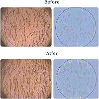 QGGQ Hair Growth Serum Roll-On 30ml — image 8