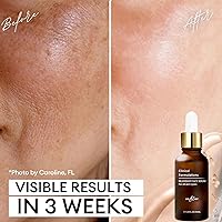 Inblair Rejuvenate Resurfacing Face Serum 1 fl.oz. — image 3