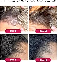 Love Ur Curls Healthy Scalp Serum Growth Hair Activator, 50mL — image 3