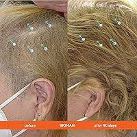 DS Labs Revita Hair Density Support Tablets - 30 Count — image 4