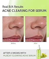 SERUMKIND Muscat Discoloration Correcting Facial Serum - 1oz — image 4