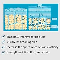 Serious Skincare Anti-Cellulite Cryo-Cinq Cold Sculpting Body Cream 8 oz — image 4