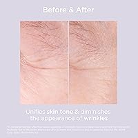 Glicoisdin 15 Exfoliant Gel with Glycolic Acid, 1.76oz — image 7