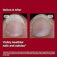 ISDIN Si-Nails Nail Strengthening Serum 0.08 FL OZ — image 6