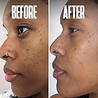 Beautiste Dark Spot Corrector Serum — image 7