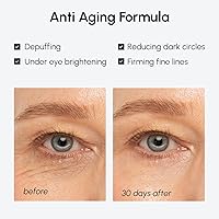 MAREE Under Eye Balm Stick Hydrating - Retinol & Caffeine for Dark Circles & Wrinkles — image 4