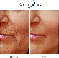 Dermlogic Anti Aging Resurfacing Peel Pads — image 6