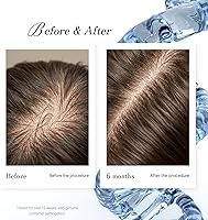 Simone Tec DNA-Pollen Hair Growth Treatment 10mL — image 5