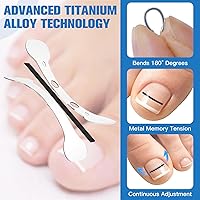 Asinkiher Titanium Alloy Ingrown Toenail Treatment Kit — image 4