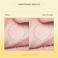 philosophy purity made simple pore extractor clay mask — image 6