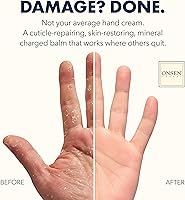 Onsen Nail & Cuticle Rescue Kit — image 2