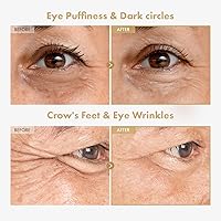 TOSOWOONG Ginseng Plus Retinal Eye Serum 30ml — image 2