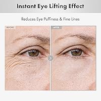 NatureKind Hyaluron Lifting Eye Cream 15ml — image 2