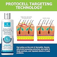 Roycederm Psoriasis Shampoo 7oz — image 4