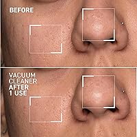 Dr. Brandt Pores No More Vacuum Cleaner - 1 oz — image 4