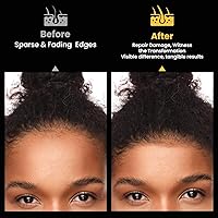 Praiasol Spoiled Batana Oil for Hair Growth 5.61oz — image 4