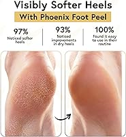 Phoenix Foot Peel Moisturizing Gel Socks for Men - Extra Large (2 Pairs) — image 2