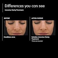 PCA SKIN Acne Control Skin Care Set — image 7