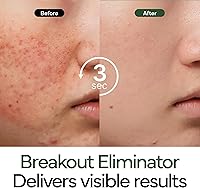 IVOSKIN Intensive Cica Repair Cream 1.76oz — image 4